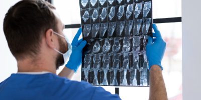 nurse-looking-radiography-side-view